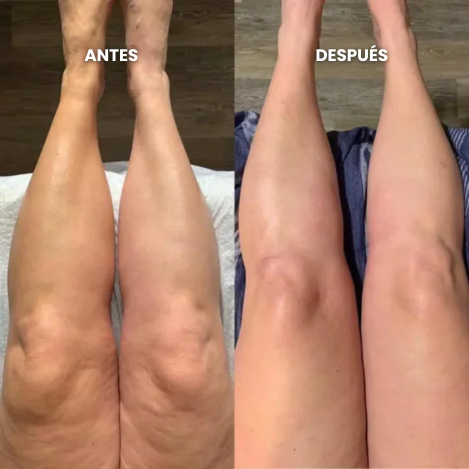 Antes y después